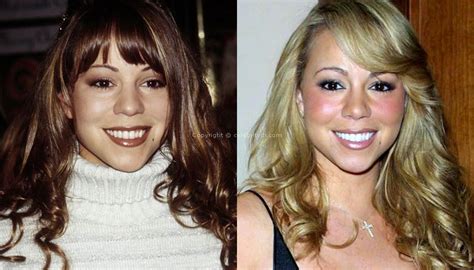 mariah carey boob job|15 Celebs Who Opened Up About Their Plastic Surgery.